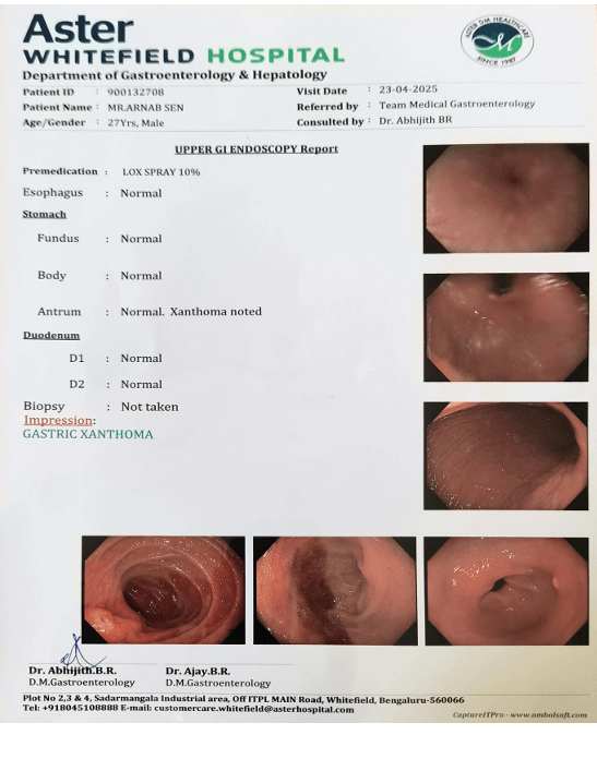 Upper GI Endoscopy Report