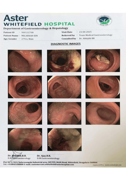 Upper GI Endoscopy Report 2
